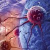 World Head and Neck Cancer Day