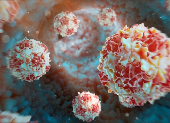 polio virus in Karachi