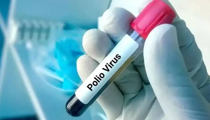 new polio case in KP
