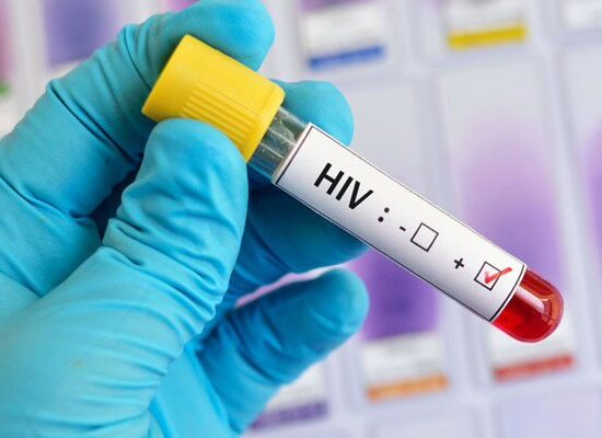 HIV Cases